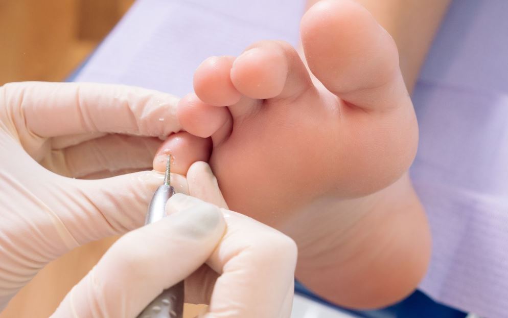 Podiatry Dubin City Centre
